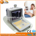 cheap price black and white portable ultrasound